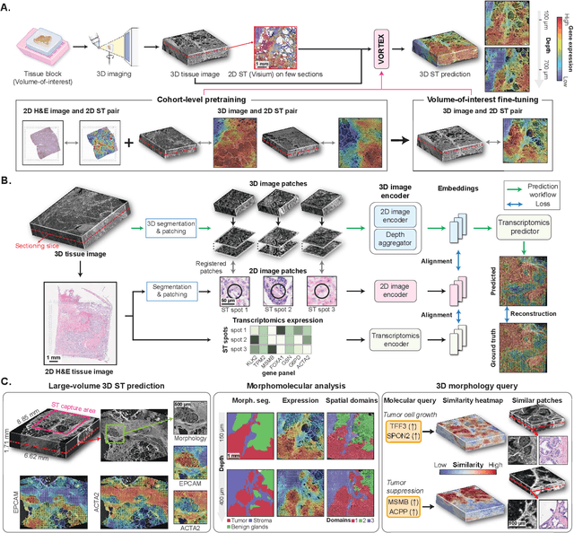 Figure 1 for AI-driven 3D Spatial Transcriptomics