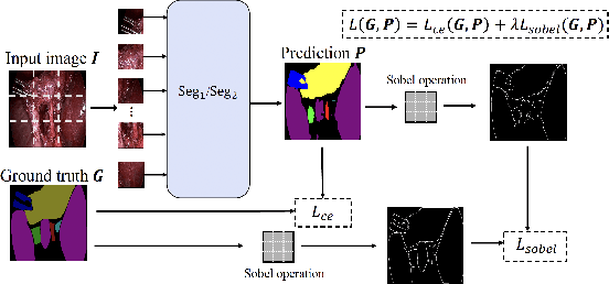 Figure 3 for Automated Assessment of Critical View of Safety in Laparoscopic Cholecystectomy