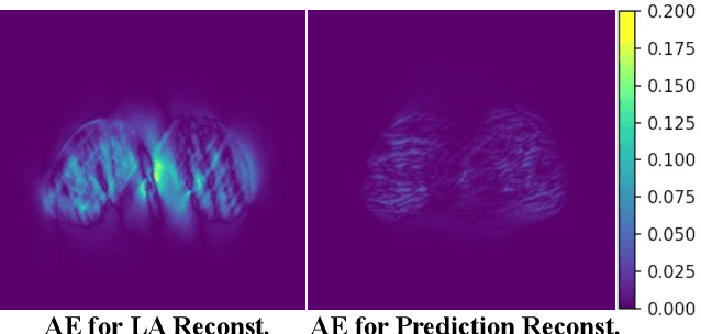Figure 2 for Diffusion-based Sinogram Interpolation for Limited Angle PET