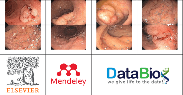Figure 2 for ERCPMP: An Endoscopic Image and Video Dataset for Colorectal Polyps Morphology and Pathology