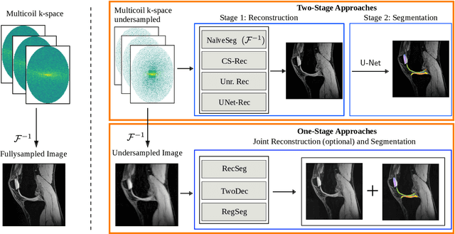 Figure 1 for Understanding Benefits and Pitfalls of Current Methods for the Segmentation of Undersampled MRI Data