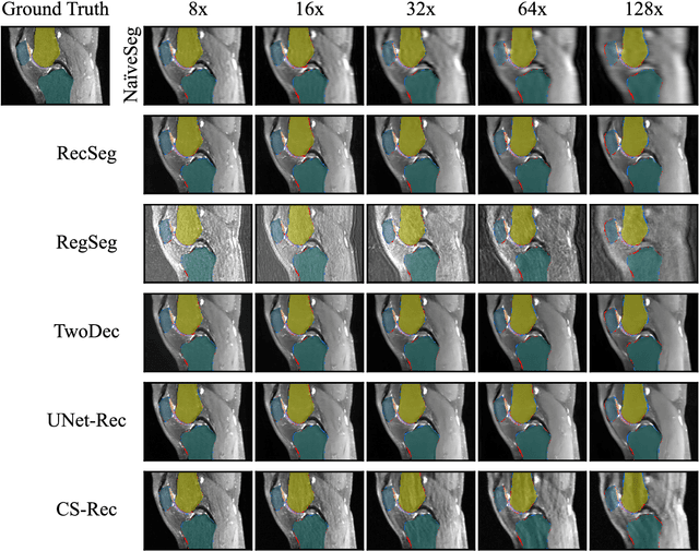 Figure 2 for Understanding Benefits and Pitfalls of Current Methods for the Segmentation of Undersampled MRI Data