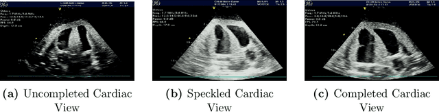 Figure 1 for CACTUS: An Open Dataset and Framework for Automated Cardiac Assessment and Classification of Ultrasound Images Using Deep Transfer Learning