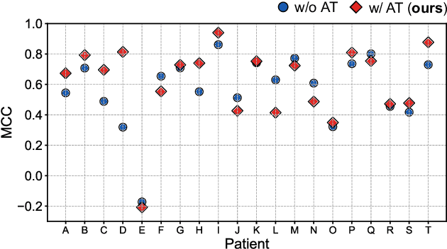 Figure 4 for EEG-Based Inter-Patient Epileptic Seizure Detection Combining Domain Adversarial Training with CNN-BiLSTM Network