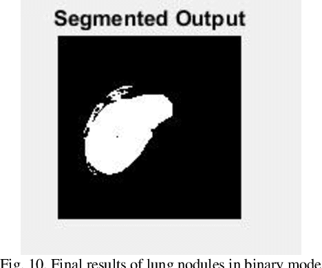 Figure 2 for Lung Cancer Detection from CT Scan Images based on Genetic-Independent Recurrent Deep Learning