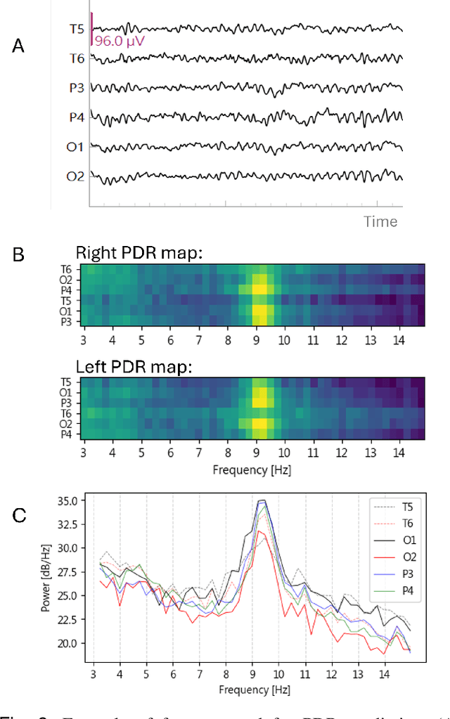 Figure 3 for A Hybrid Artificial Intelligence System for Automated EEG Background Analysis and Report Generation