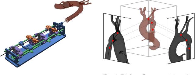 Figure 2 for 3D Guidewire Shape Reconstruction from Monoplane Fluoroscopic Images