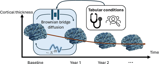 Figure 1 for Spherical Brownian Bridge Diffusion Models for Conditional Cortical Thickness Forecasting