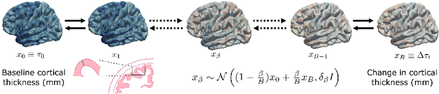Figure 3 for Spherical Brownian Bridge Diffusion Models for Conditional Cortical Thickness Forecasting