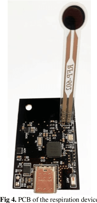 Figure 3 for Design and Implementation of an IoT-based Respiratory Motion Sensor