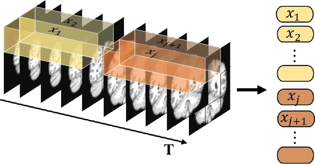 Figure 3 for Leveraging Video Vision Transformer for Alzheimer's Disease Diagnosis from 3D Brain MRI