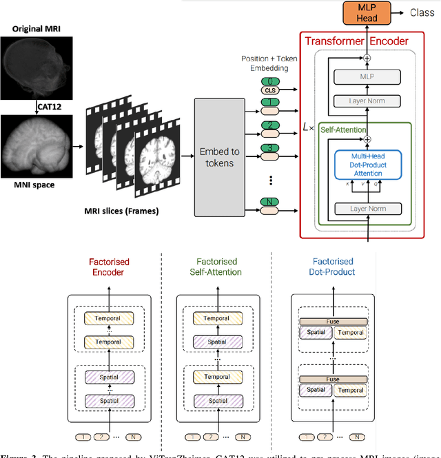 Figure 4 for Leveraging Video Vision Transformer for Alzheimer's Disease Diagnosis from 3D Brain MRI
