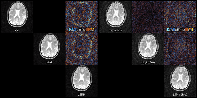 Figure 2 for Algorithms for Least-Squares Noncartesian MR Image Reconstruction