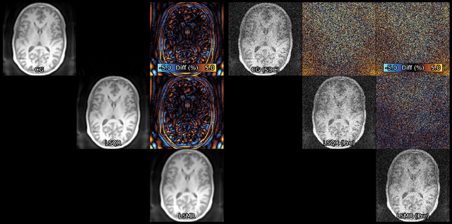 Figure 3 for Algorithms for Least-Squares Noncartesian MR Image Reconstruction