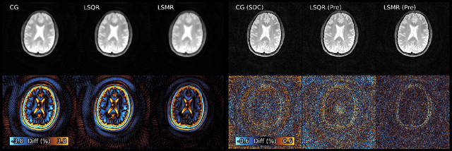Figure 4 for Algorithms for Least-Squares Noncartesian MR Image Reconstruction
