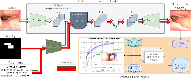Figure 1 for Clinically-guided Data Synthesis for Laryngeal Lesion Detection