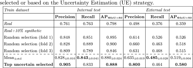 Figure 2 for Clinically-guided Data Synthesis for Laryngeal Lesion Detection