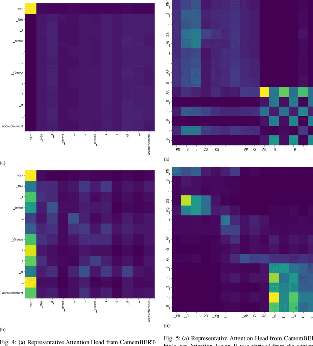 Figure 4 for Numerical Attributes Learning for Cardiac Failure Diagnostic from Clinical Narratives -- A LESA-CamemBERT-bio Approach