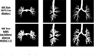 Figure 1 for Unsupervised Airway Tree Clustering with Deep Learning: The Multi-Ethnic Study of Atherosclerosis (MESA) Lung Study