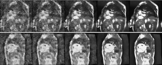 Figure 3 for Temporal and Spatial Super Resolution with Latent Diffusion Model in Medical MRI images