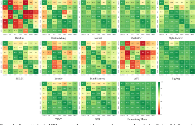 Figure 4 for Harmonizing Flows: Leveraging normalizing flows for unsupervised and source-free MRI harmonization