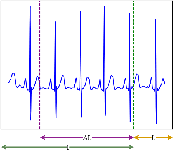 Figure 3 for FADE: Forecasting for Anomaly Detection on ECG