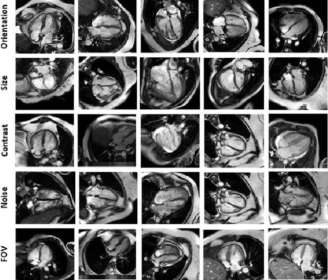 Figure 3 for CMRINet: Joint Groupwise Registration and Segmentation for Cardiac Function Quantification from Cine-MRI