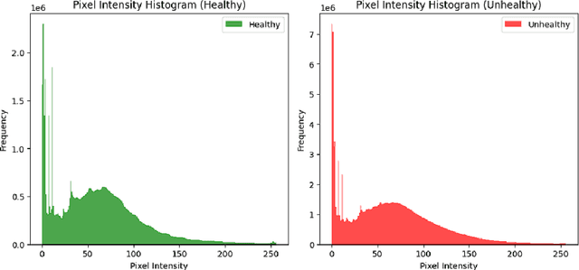Figure 3 for Leveraging AI for Automatic Classification of PCOS Using Ultrasound Imaging