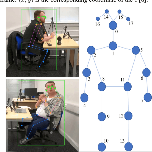 Figure 3 for Skeleton-based action analysis for ADHD diagnosis