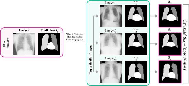 Figure 1 for Unsupervised bias discovery in medical image segmentation