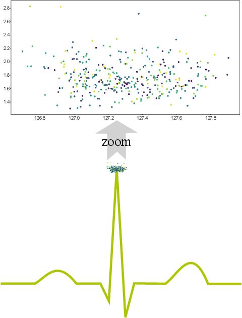 Figure 3 for Leveraging Statistical Shape Priors in GAN-based ECG Synthesis