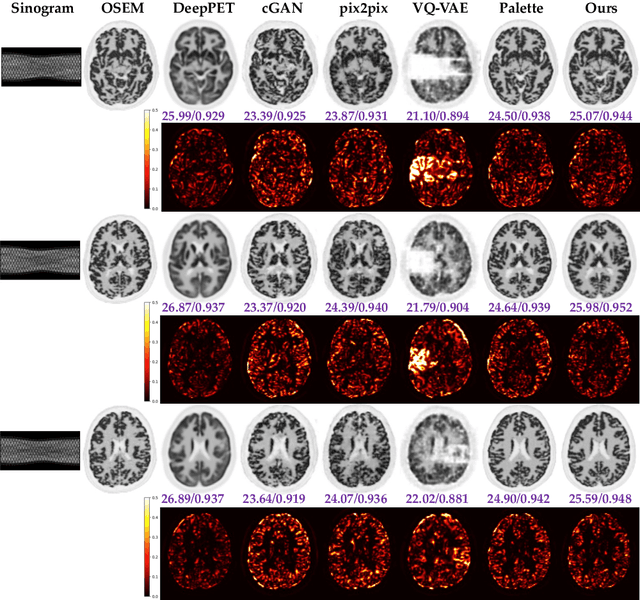 Figure 3 for Posterior-Mean Denoising Diffusion Model for Realistic PET Image Reconstruction