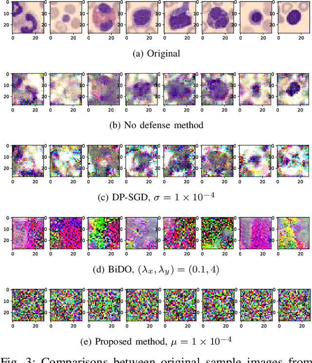 Figure 3 for Defending Against Gradient Inversion Attacks for Biomedical Images via Learnable Data Perturbation