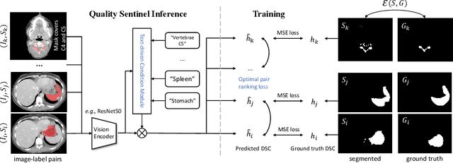 Figure 1 for Quality Sentinel: Estimating Label Quality and Errors in Medical Segmentation Datasets