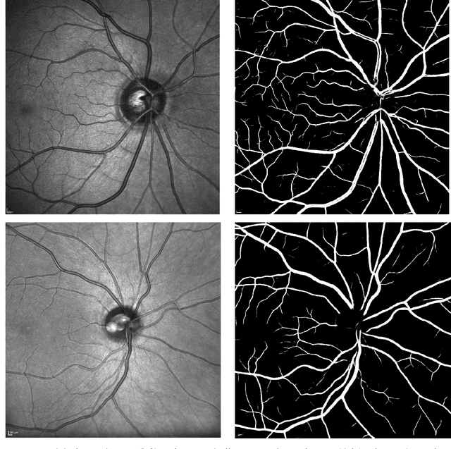 Figure 4 for A publicly available vessel segmentation algorithm for SLO images