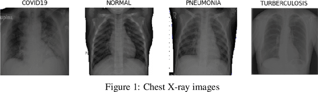 Figure 2 for Chest Disease Detection In X-Ray Images Using Deep Learning Classification Method