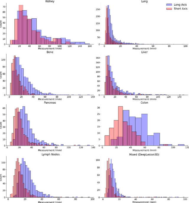 Figure 2 for The ULS23 Challenge: a Baseline Model and Benchmark Dataset for 3D Universal Lesion Segmentation in Computed Tomography