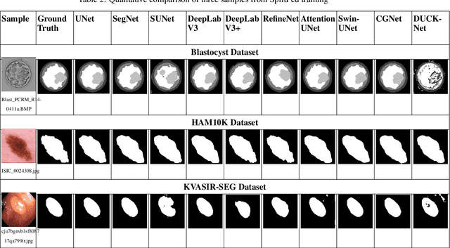 Figure 4 for MedSegNet10: A Publicly Accessible Network Repository for Split Federated Medical Image Segmentation
