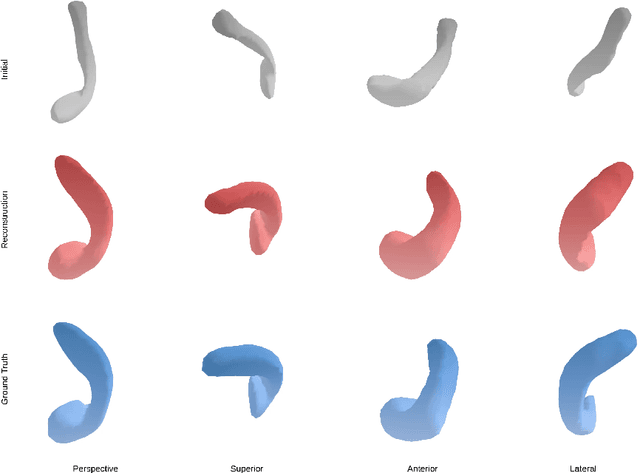 Figure 4 for Implicit Neural Shape Optimization for 3D High-Contrast Electrical Impedance Tomography