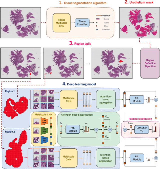 Figure 2 for NMGrad: Advancing Histopathological Bladder Cancer Grading with Weakly Supervised Deep Learning