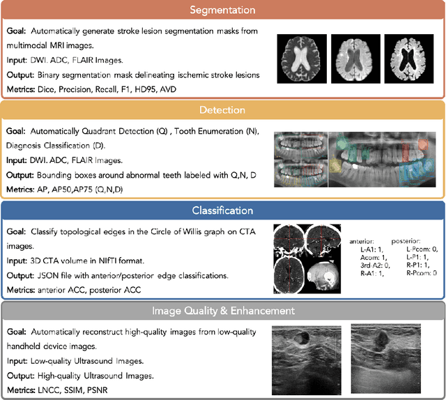 Figure 3 for ReX-MLE: The Autonomous Agent Benchmark for Medical Imaging Challenges