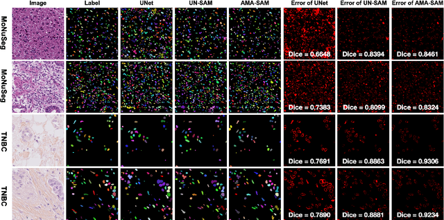 Figure 2 for AMA-SAM: Adversarial Multi-Domain Alignment of Segment Anything Model for High-Fidelity Histology Nuclei Segmentation