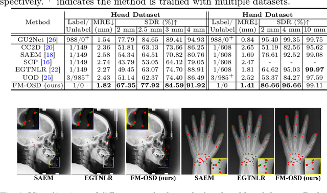 Figure 2 for FM-OSD: Foundation Model-Enabled One-Shot Detection of Anatomical Landmarks