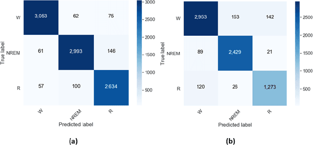 Figure 4 for Classification of sleep stages from EEG, EOG and EMG signals by SSNet