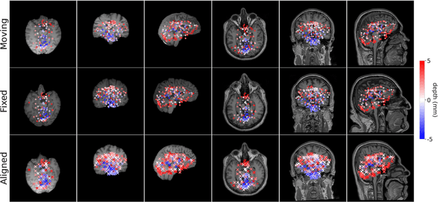 Figure 3 for BrainMorph: A Foundational Keypoint Model for Robust and Flexible Brain MRI Registration