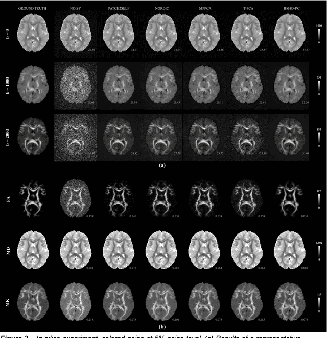 Figure 3 for BM4D-PC: nonlocal volumetric denoising of principal components of diffusion-weighted MR images