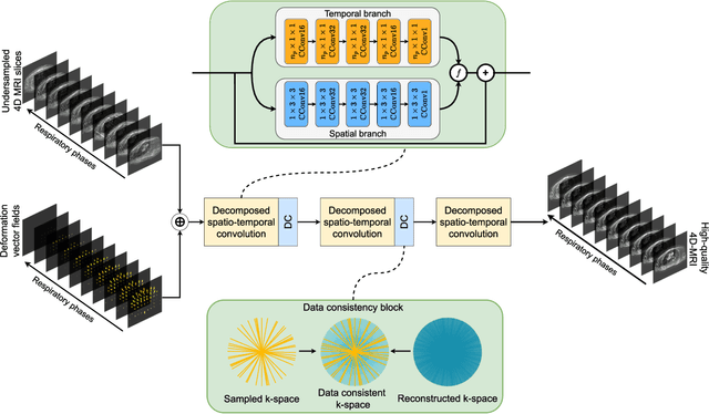 Figure 1 for Accelerated respiratory-resolved 4D-MRI with separable spatio-temporal neural networks