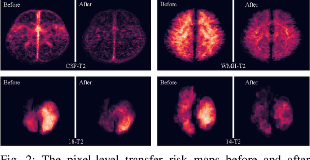 Figure 2 for Transfer Risk Map: Mitigating Pixel-level Negative Transfer in Medical Segmentation
