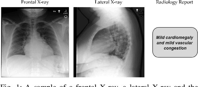 Figure 1 for Any-to-Any Vision-Language Model for Multimodal X-ray Imaging and Radiological Report Generation
