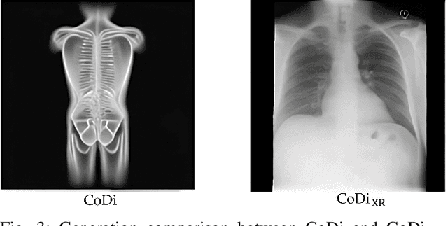 Figure 3 for Any-to-Any Vision-Language Model for Multimodal X-ray Imaging and Radiological Report Generation